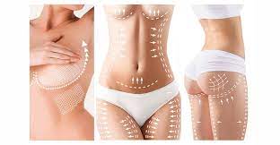 Your Guide to Affordable Abdominoplasty in Miami post thumbnail image
