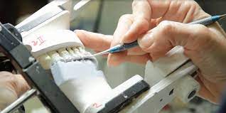 Bridging Science and Art: The Dental Lab Story post thumbnail image